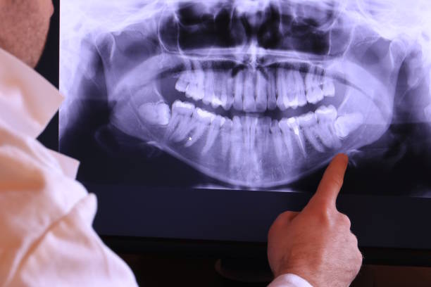 Best Emergency Cosmetic Dentistry in Sevierville, TN